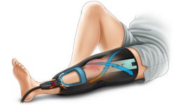 wraps-tech-knee-illustration
